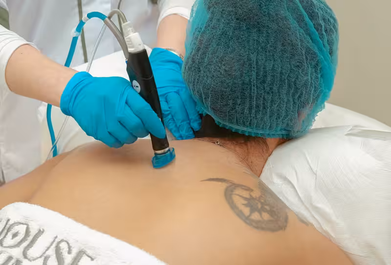 Booking a Student Microsuction Appointment in Milton Keynes: Doctor Doctor for Booking a Student Microsuction Appointment in Milton Keynes - Student Discounts At Milton Keynes: Private Microsu...